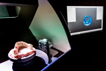 Scanner 3D dentale